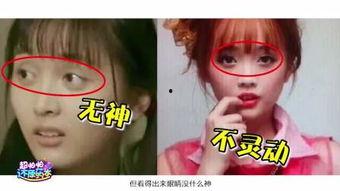 激光笔点痣视频,告别瑕疵肌肤